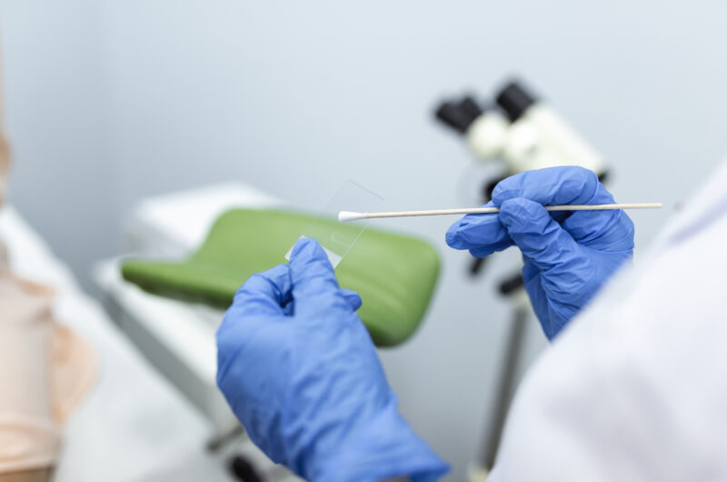 Vaginal Smear. Close-up of doctor hand holds gynecological examination instruments. Gynecologist working in the obstetrics and gynecology clinic.
